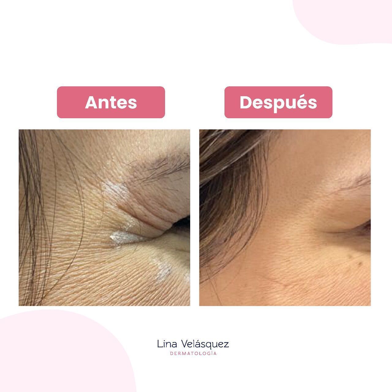 Lina Velásquez Tafur-3