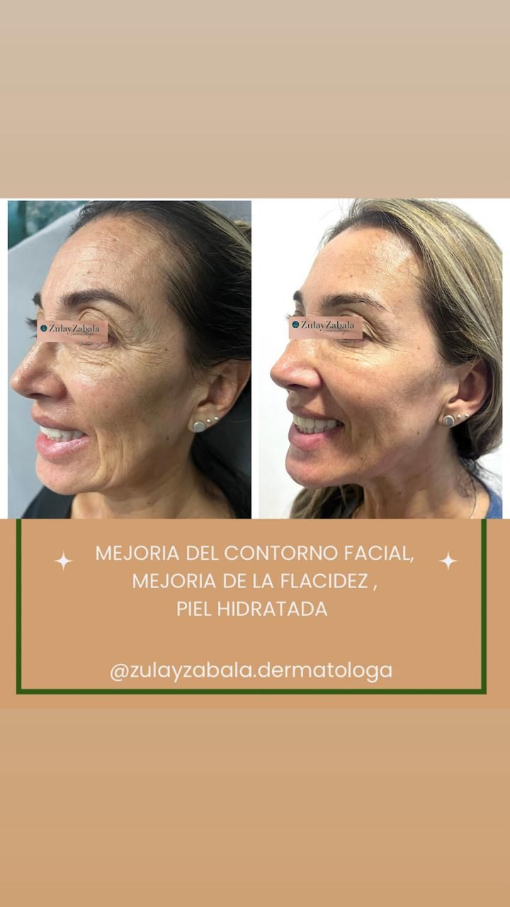 Zulay Angelica Zabala Suarez-42