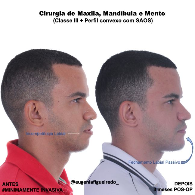 Eugênia Figueiredo-27