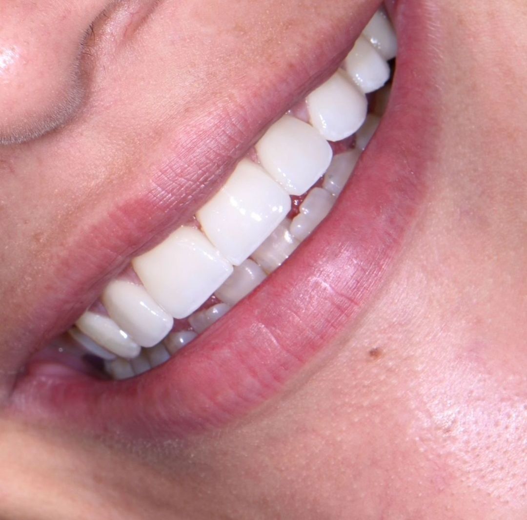 Mauricio Arias Merino-6