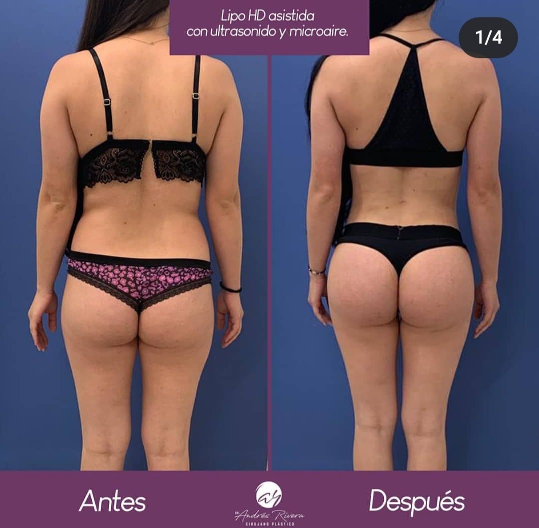 Andrés Rivera López-25