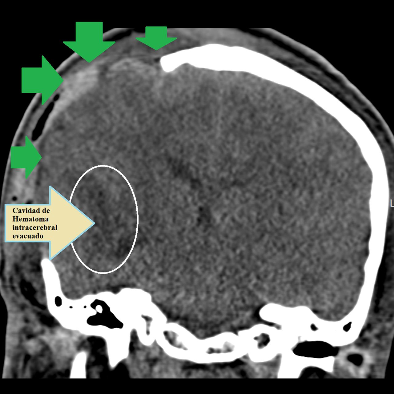 David Tafur Muñoz-1608