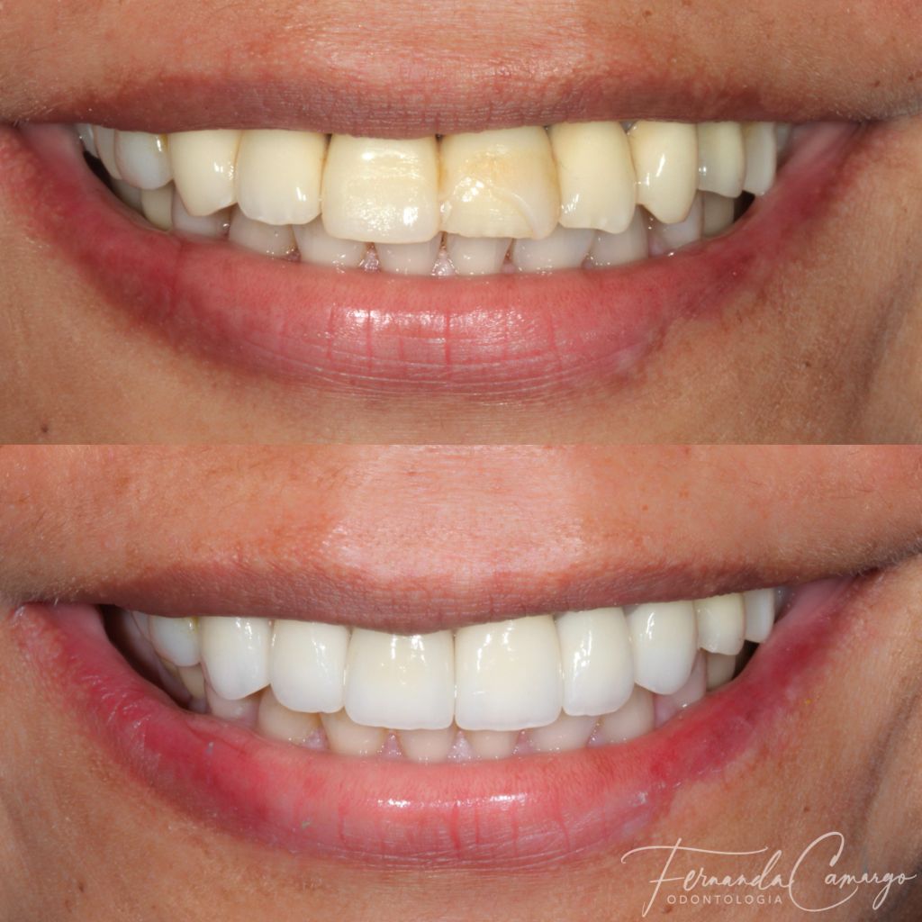 Fernanda Camargo Silveira-8