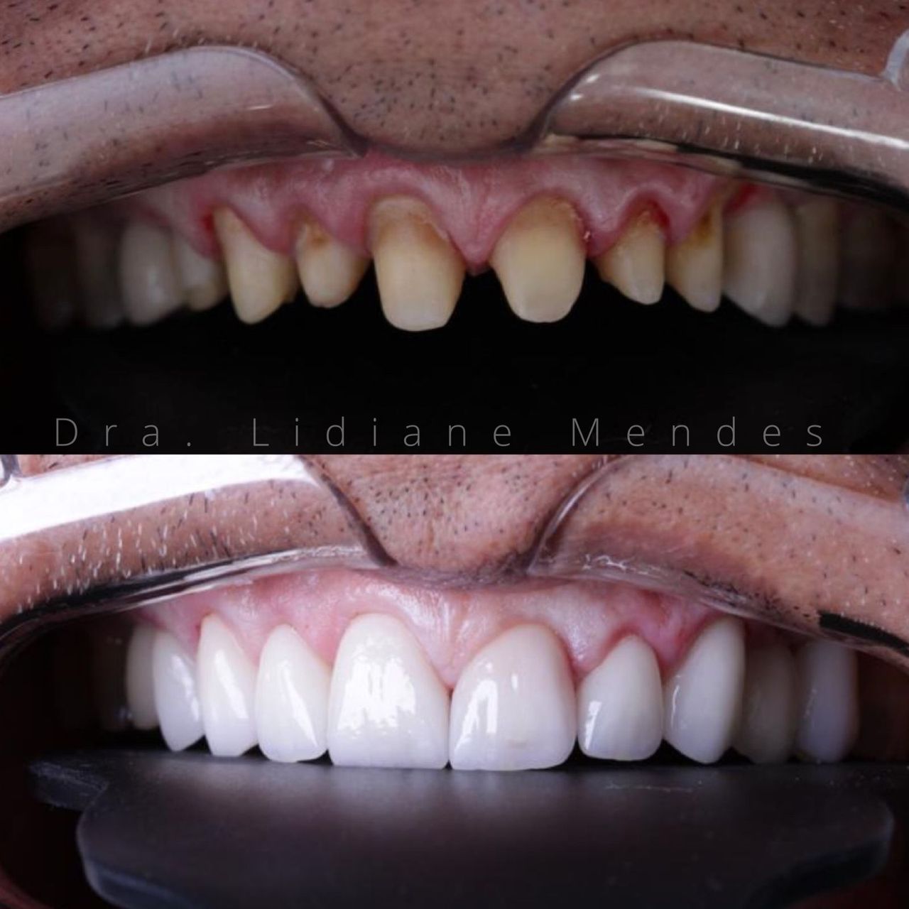 Lidiane Morais Mendes-12