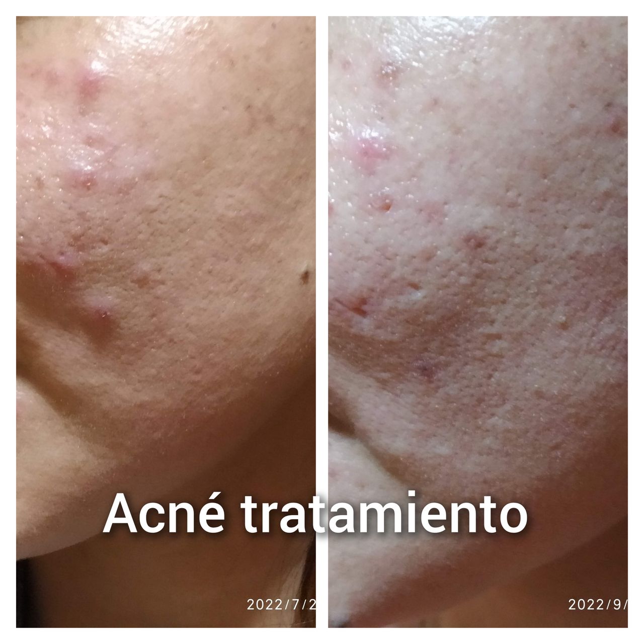 Alejandra Meijide-11