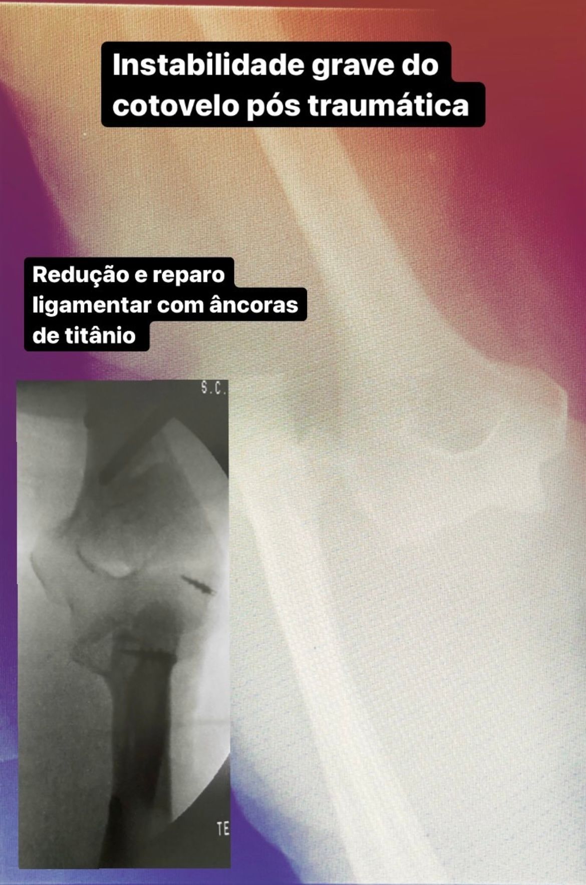 Fernando Gouvea-28