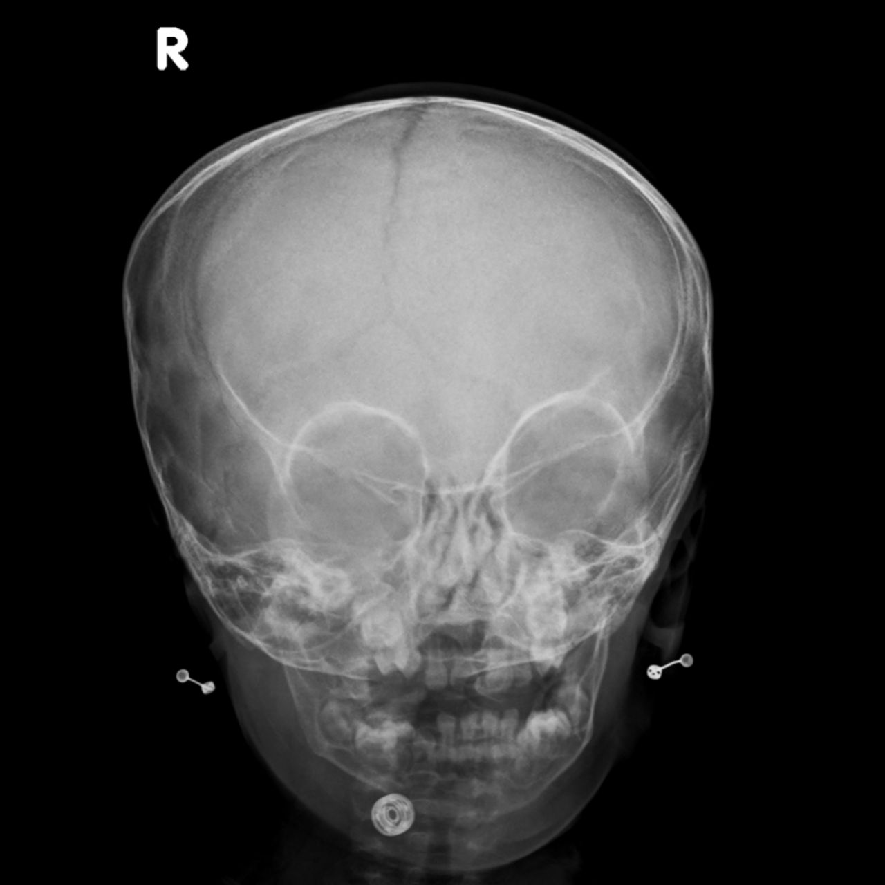 David Tafur Muñoz-2009