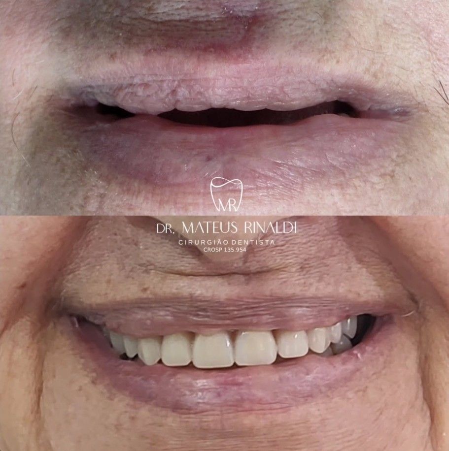 Mateus Rinaldi Lucio Martins-8