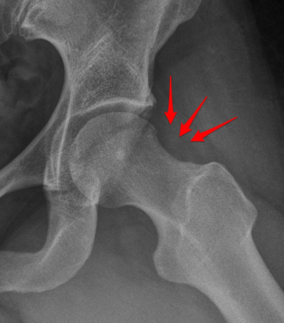 Marcus Vinicius Crestani-4