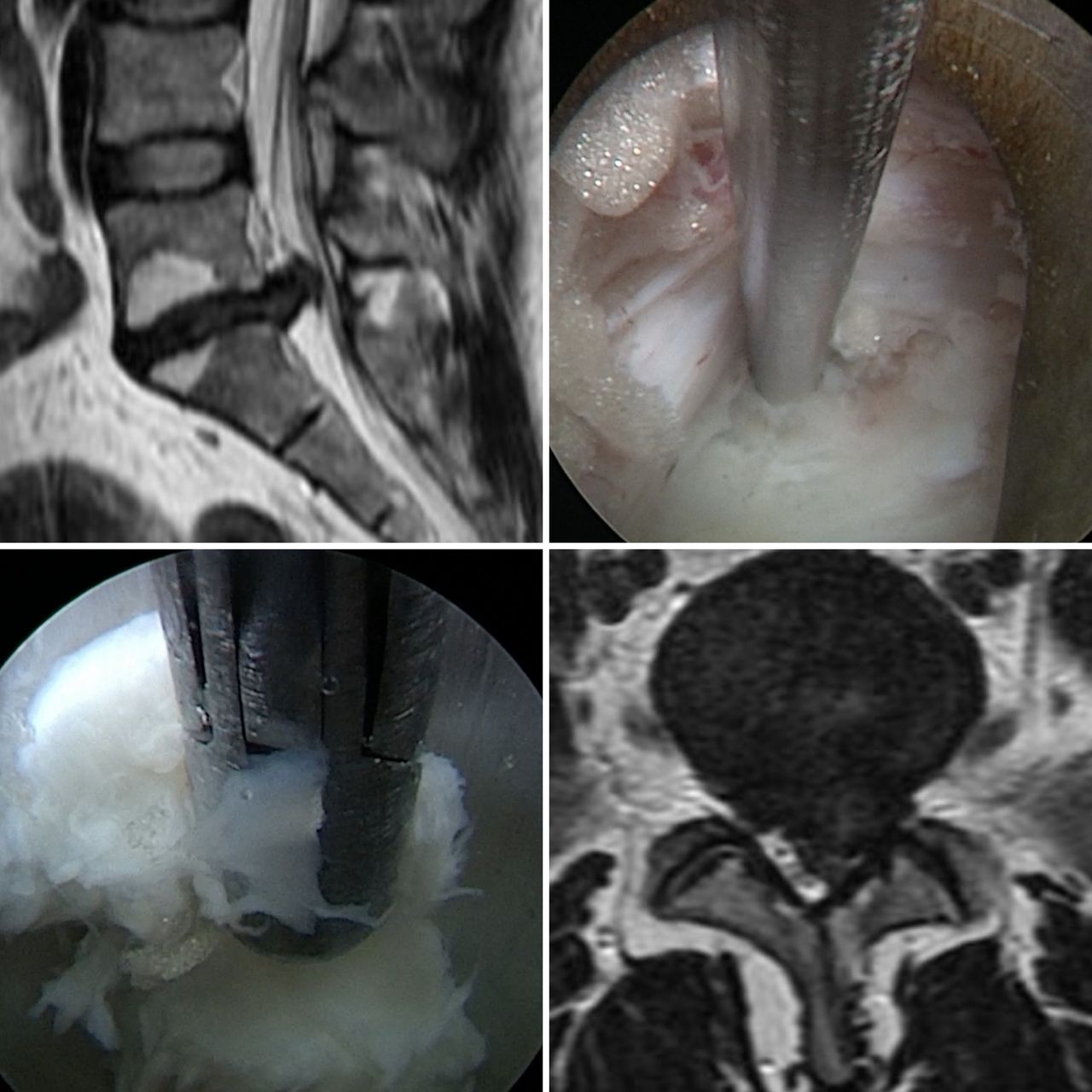 José Lopes Sousa Filho-8