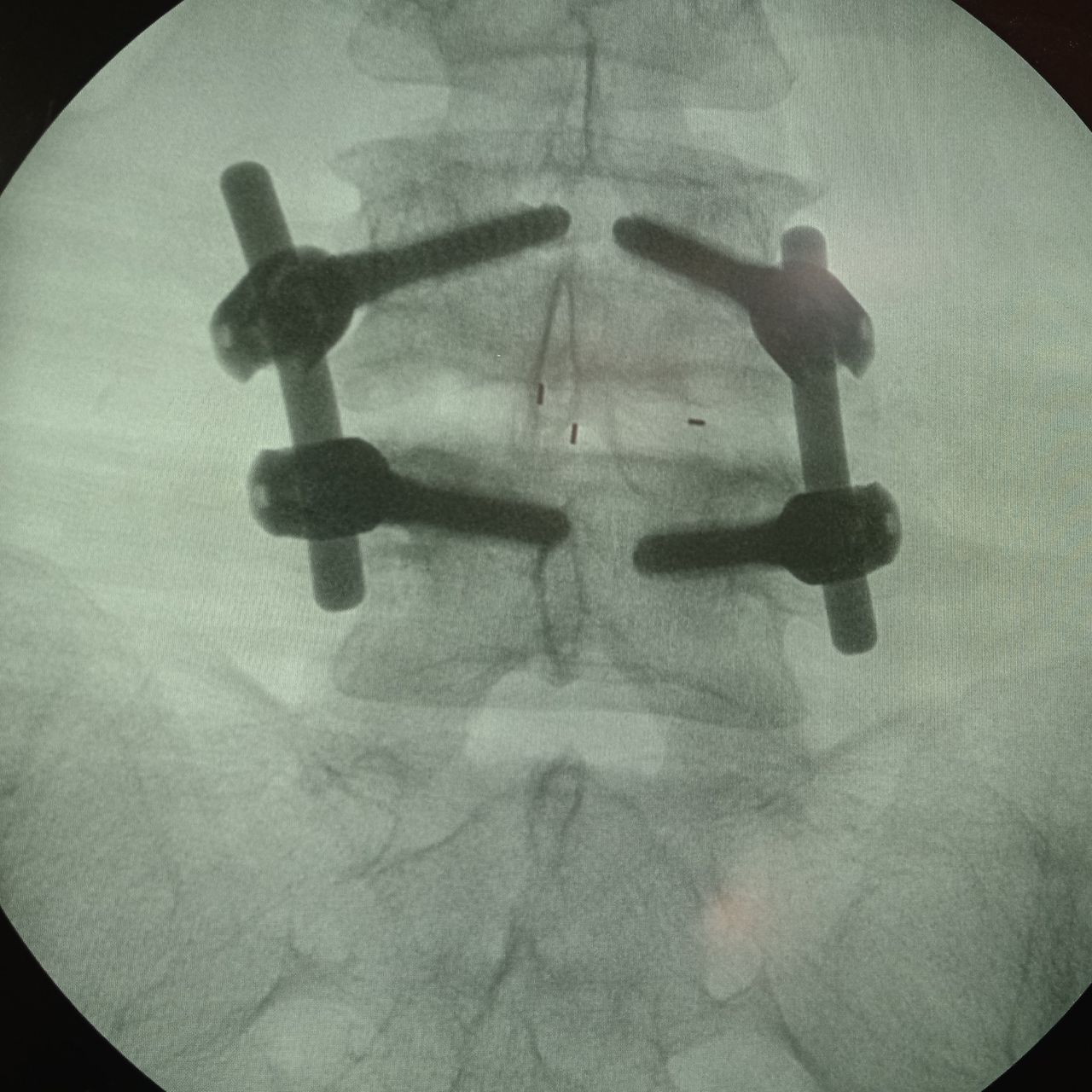 David Tafur Muñoz-1236