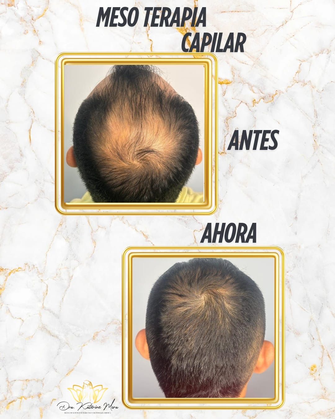 Katerine Mora Cardenas-1