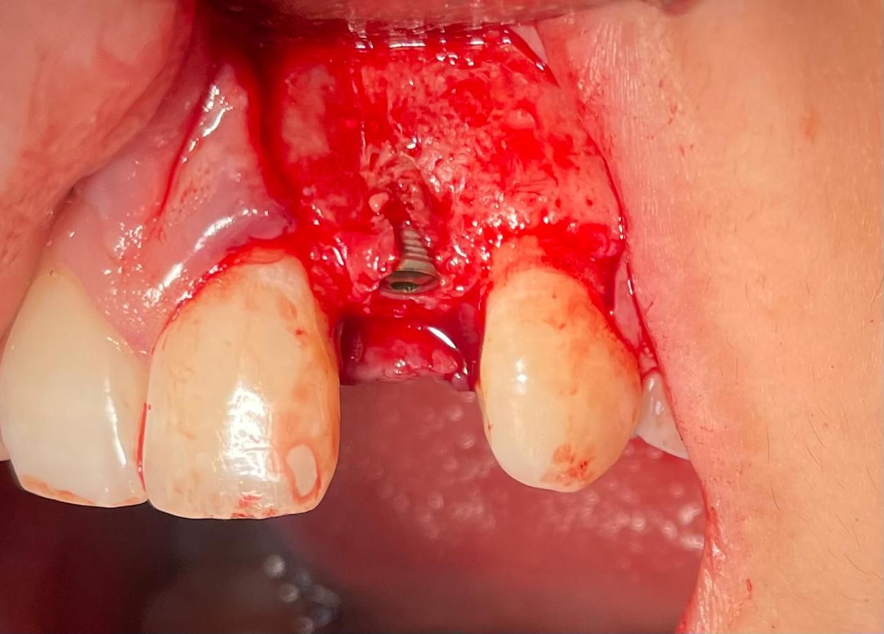 Natalia Grajales Fernández-0