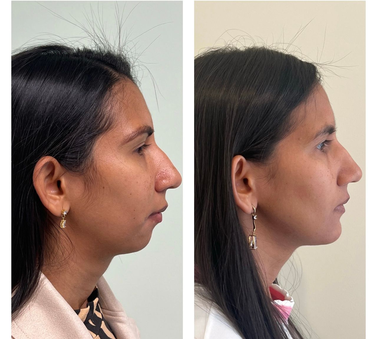 Daniel Assunção-13