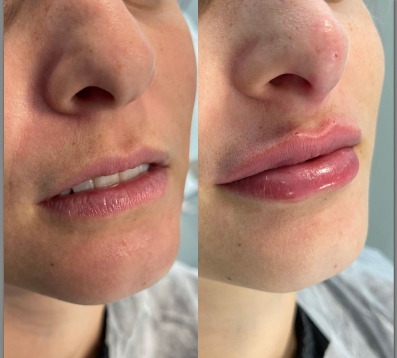 Ana Carolina Paschoalino-8