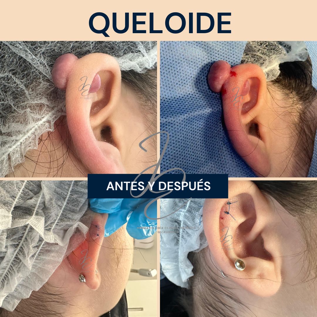 Jeanny Epieyu Diaz-18