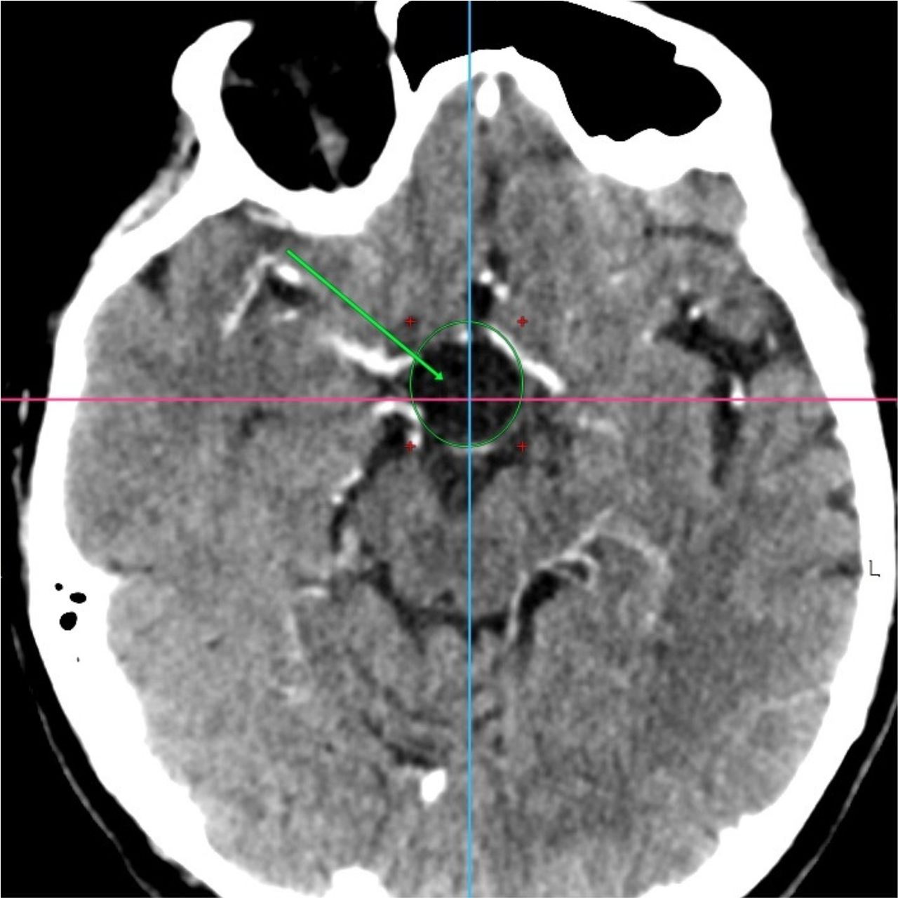 David Tafur Muñoz-1388