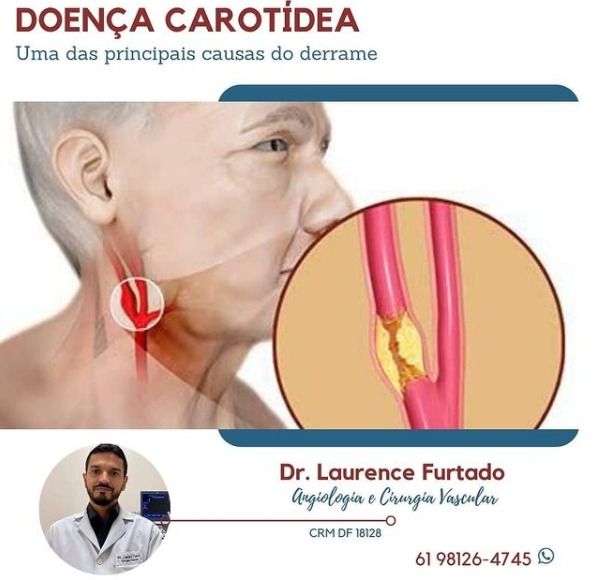 Laurence Furtado E Souza-5