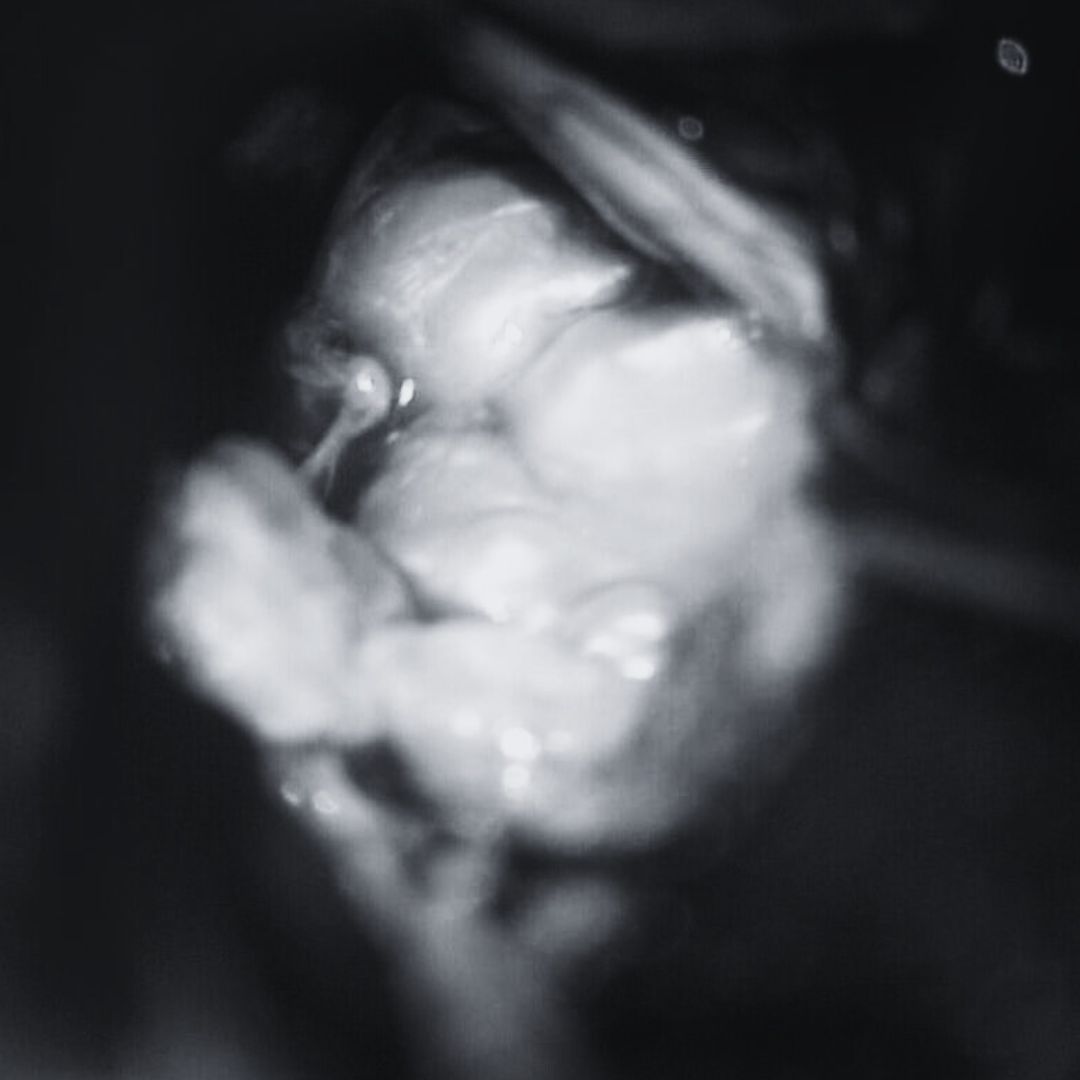 David Tafur Muñoz-2313