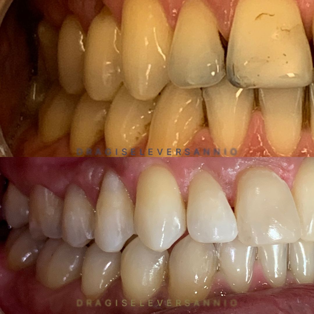 Gisele De Carvalho Versannio-1