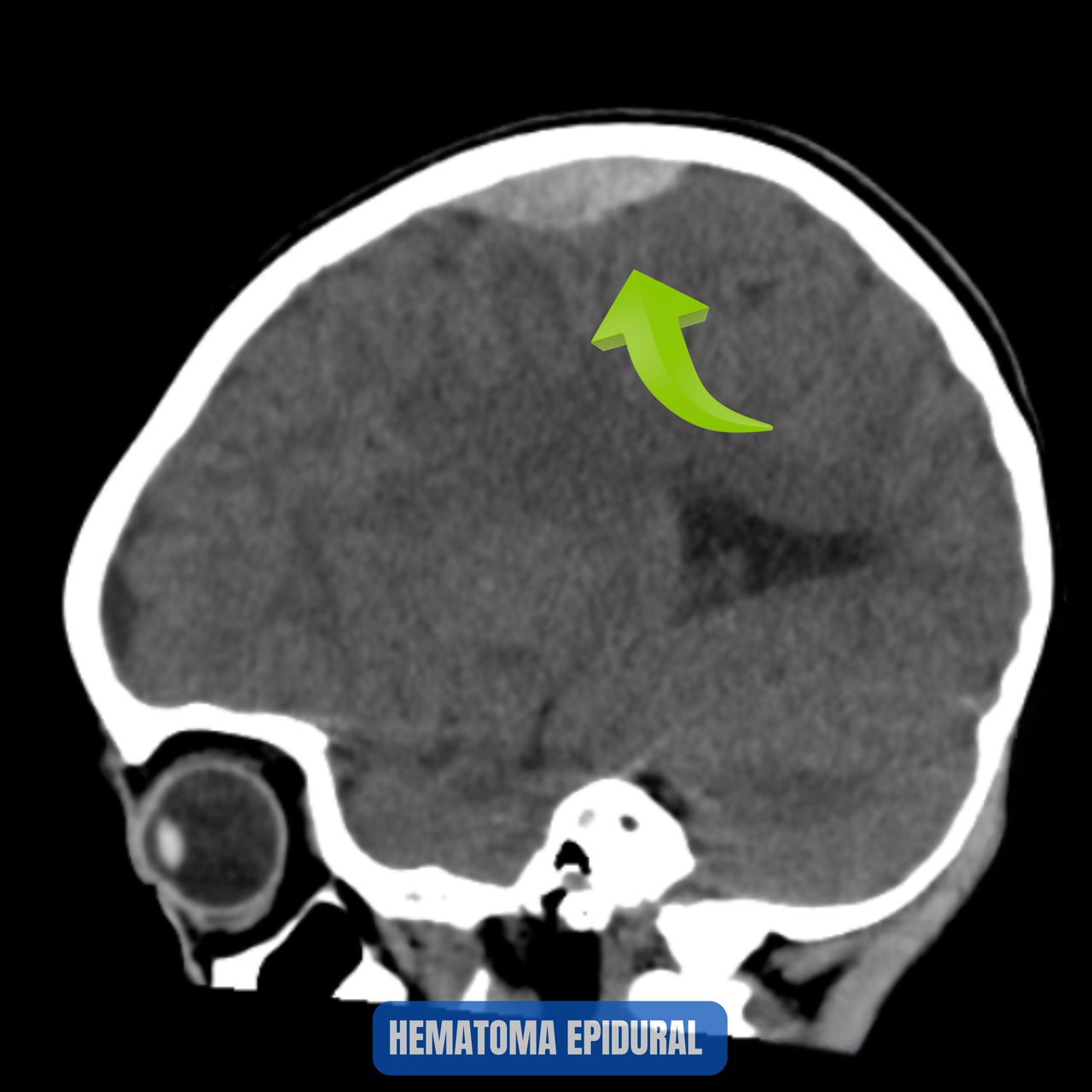 David Tafur Muñoz-1042