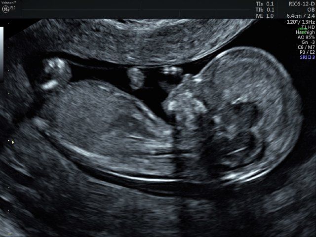 Raul Javier Banderas Pumarino-11