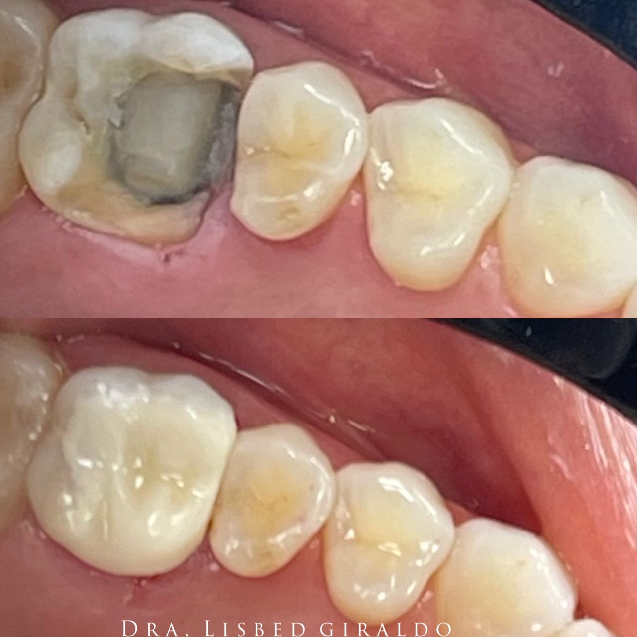 Lisbed Giraldo Olarte-13