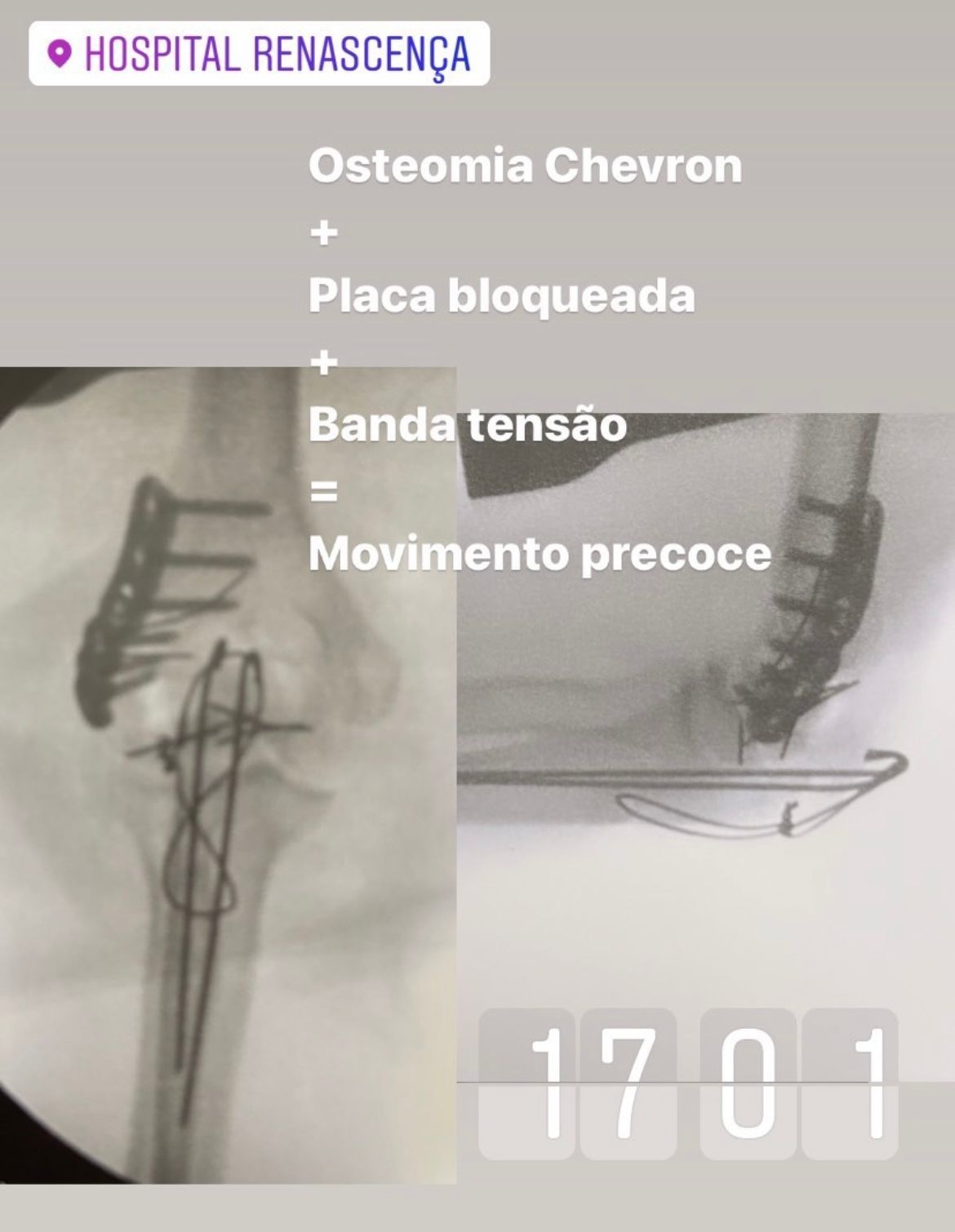 Fernando Gouvea-13