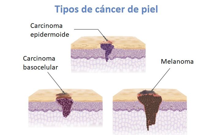 Laura Carvajal Betancur-8