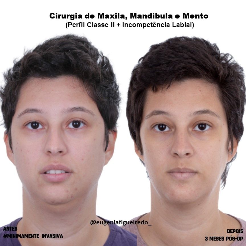 Eugênia Figueiredo-17