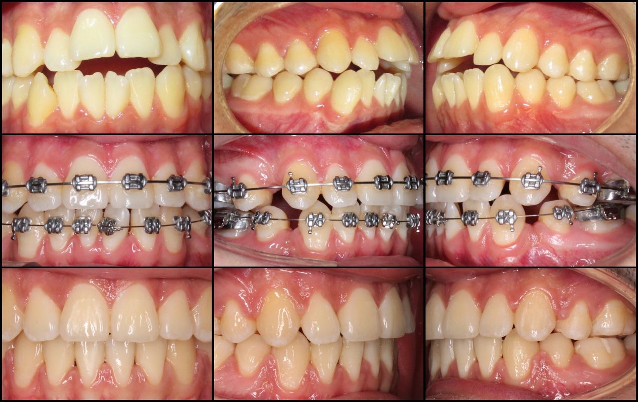 Carlos Manterola Marchant-6