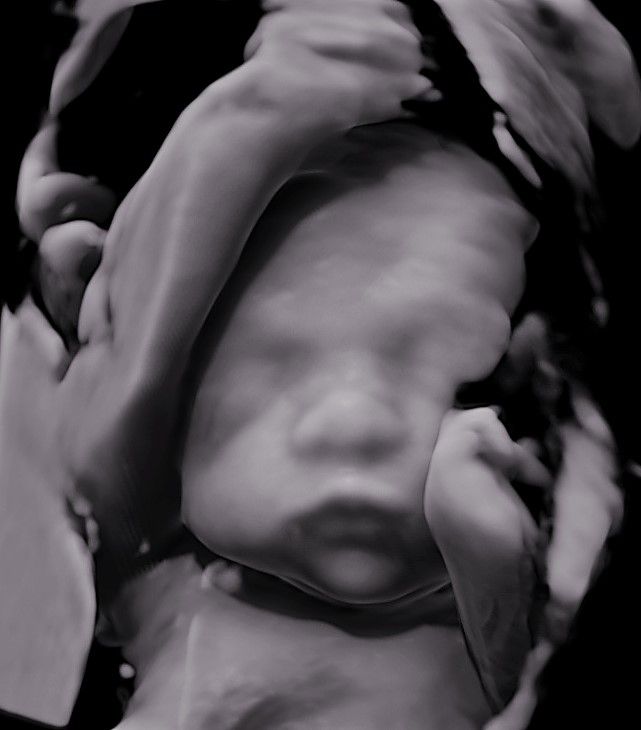 Charles Schwantz De Lima-31