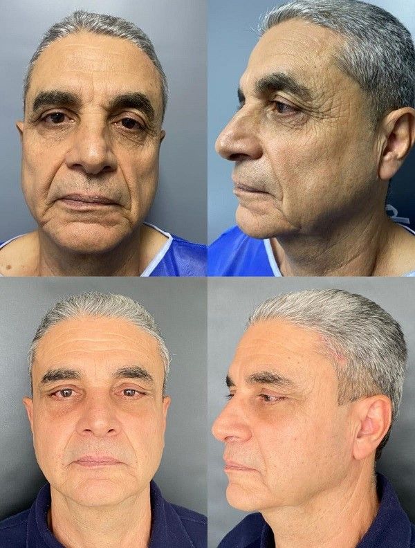 Ana Lucia Rave Martinez-14