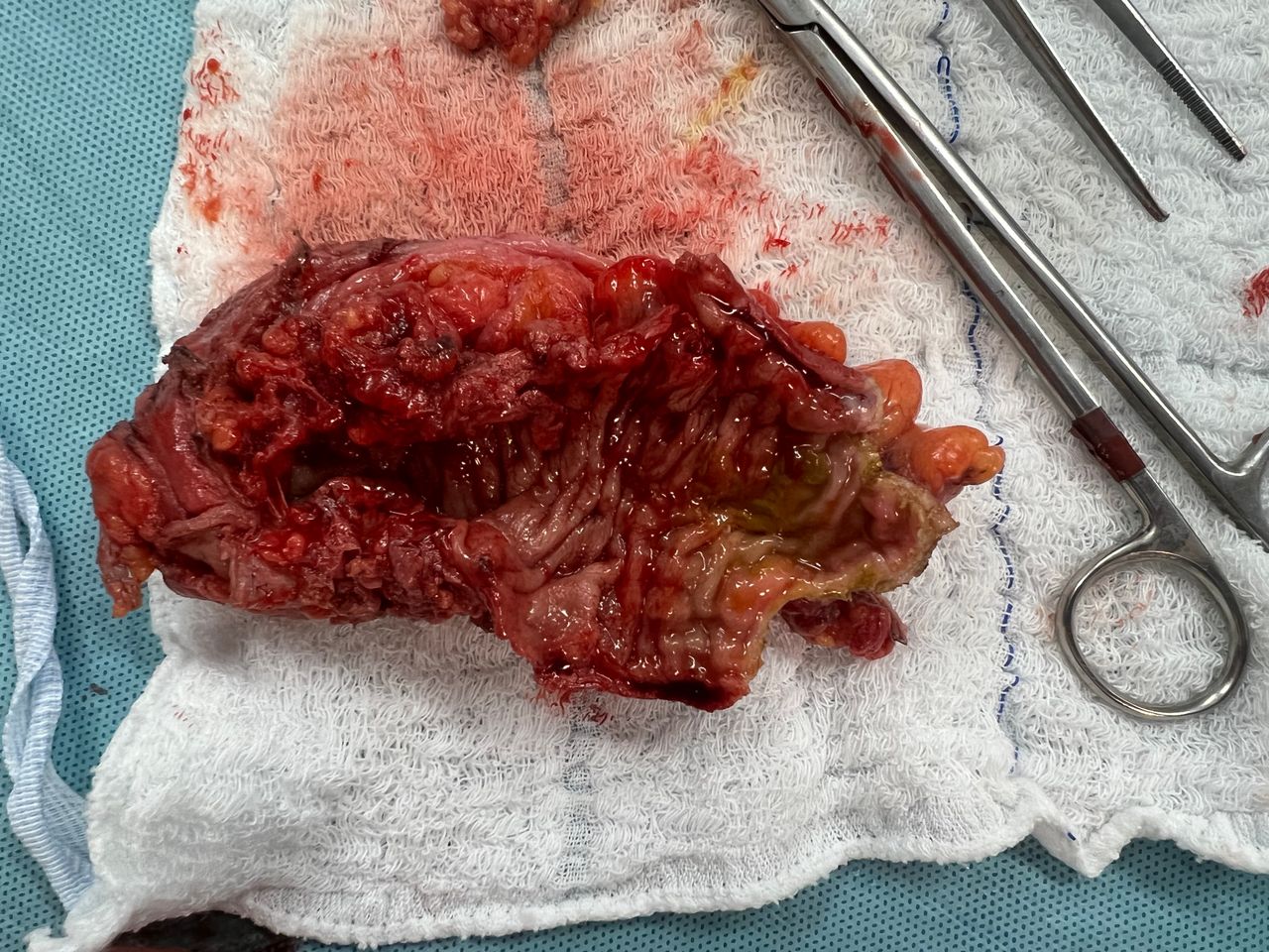 João Guilherme Pinto Vinagre-5