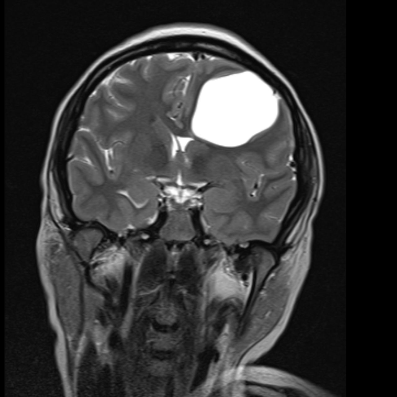 David Tafur Muñoz-1673