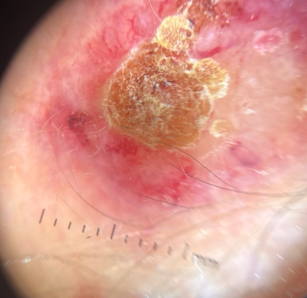 Marcos Ortiz Perez-10