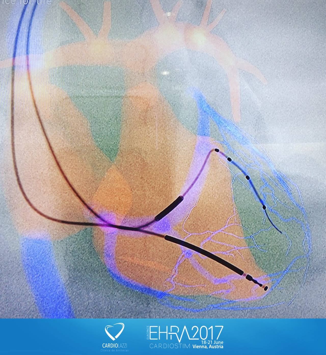 Frederico Bartolazzi-14