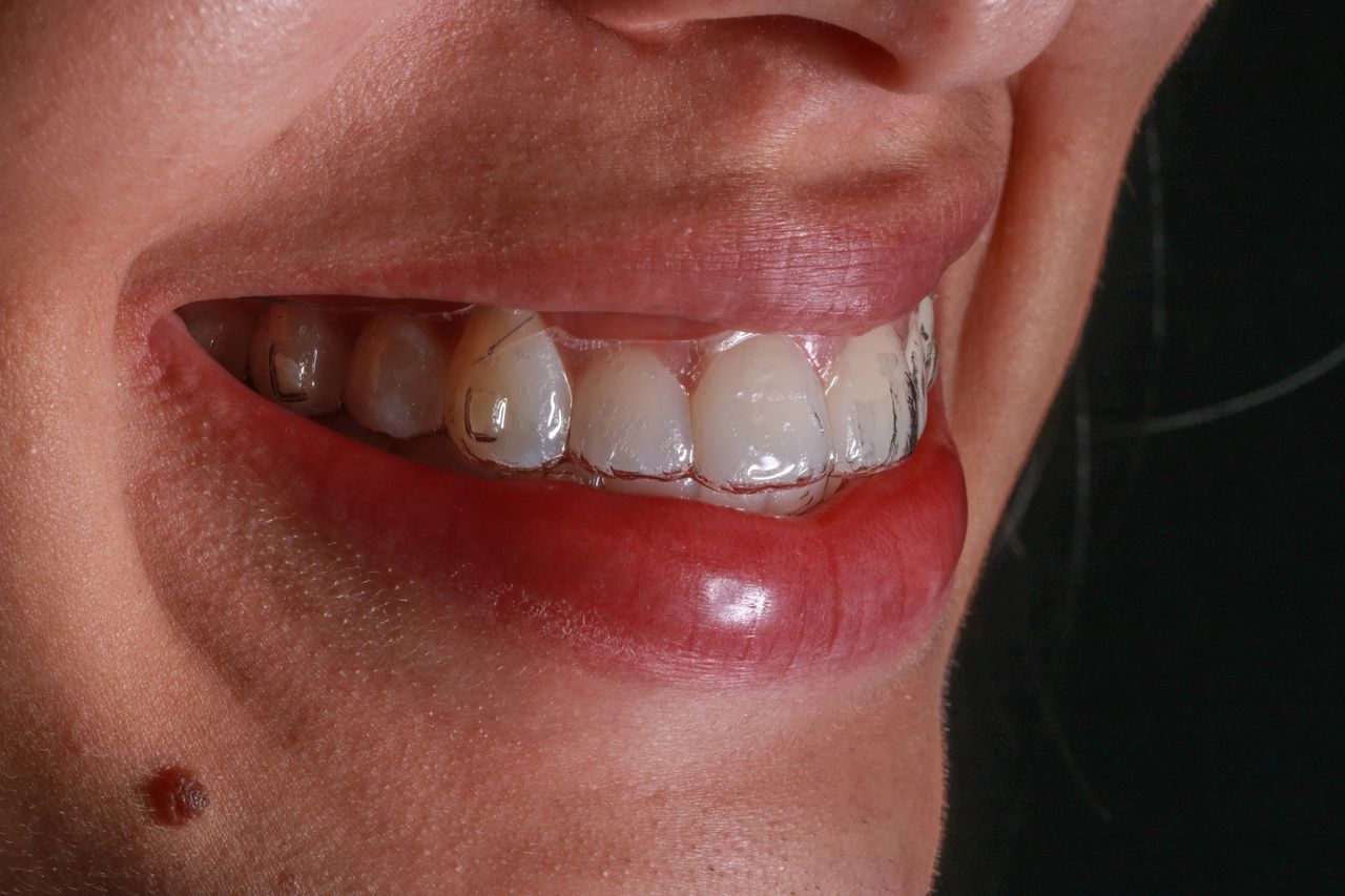 Roberto Soares Da Silva Júnior-5