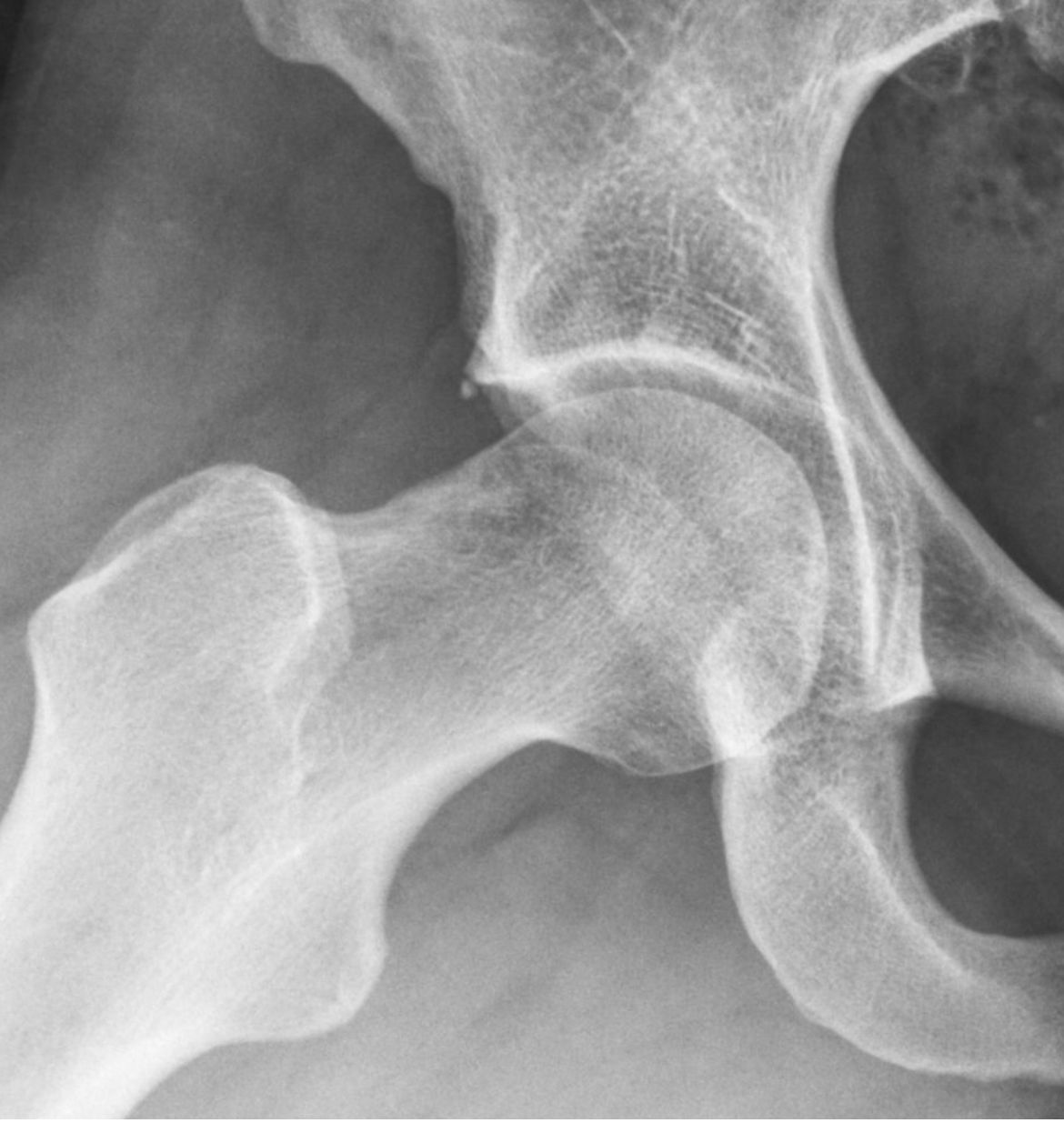 Marcus Vinicius Crestani-0