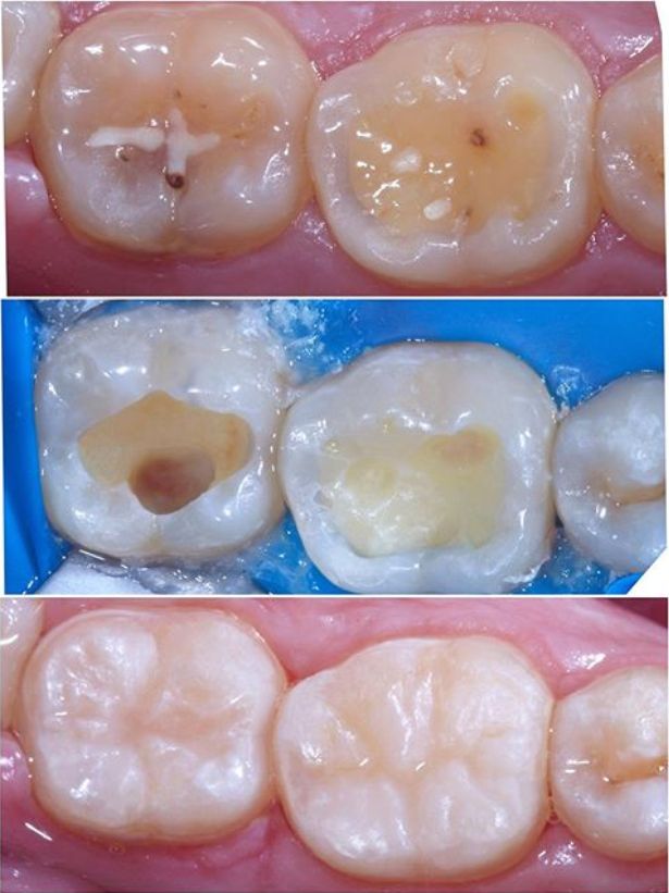 Daniel De Souza Pereira-78