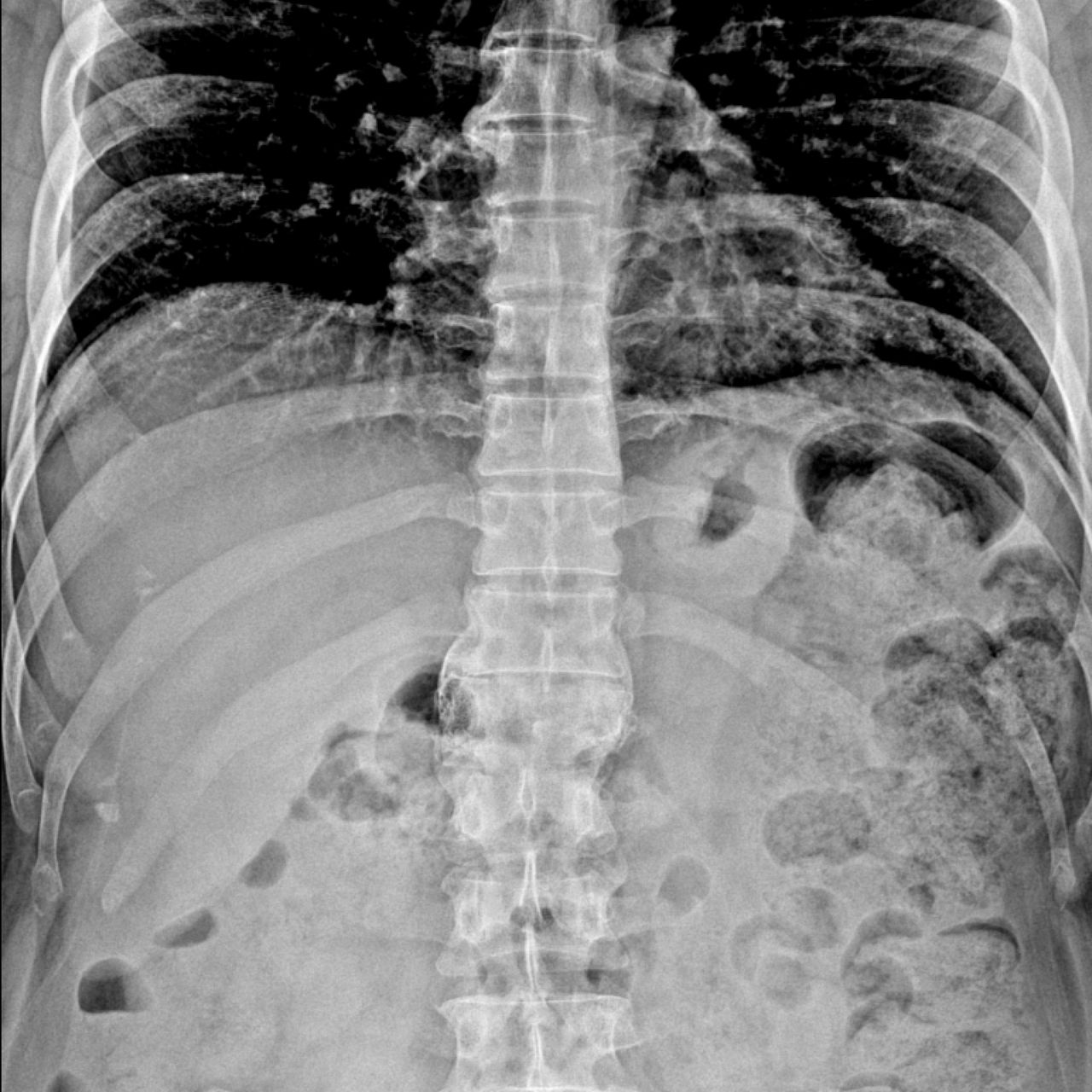 David Tafur Muñoz-1400