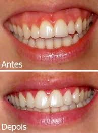 Juliana Pelegrini-18