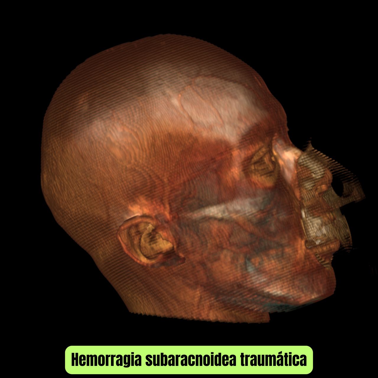 David Tafur Muñoz-1070