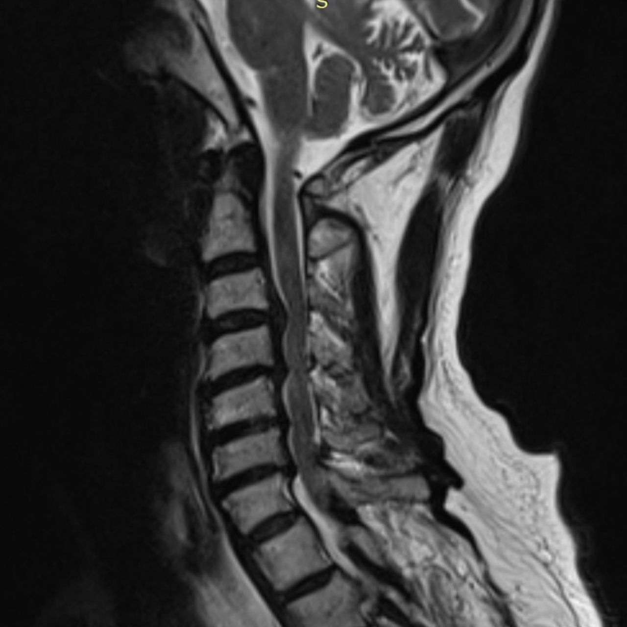 David Tafur Muñoz-2178