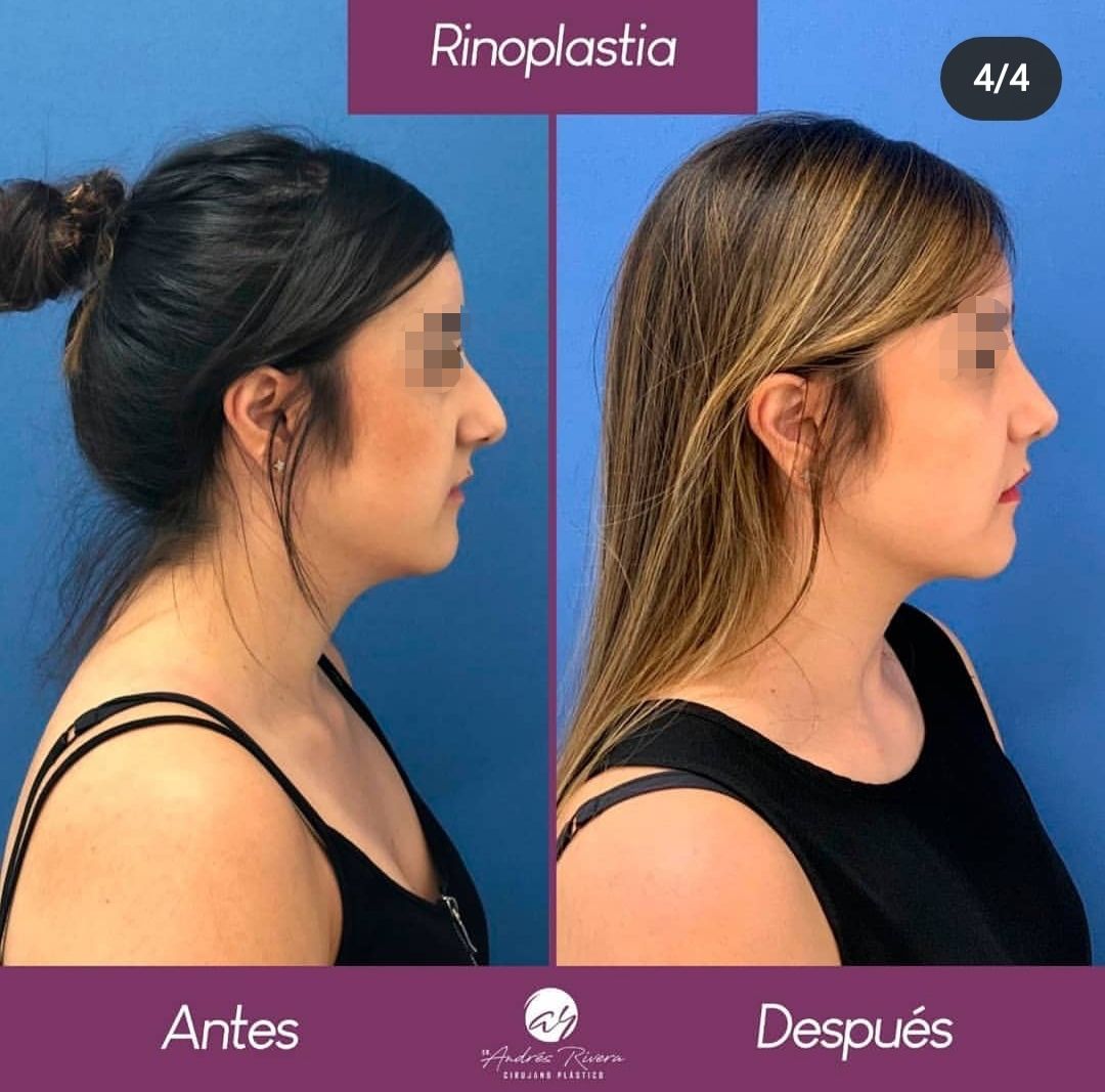 Andrés Rivera López-21