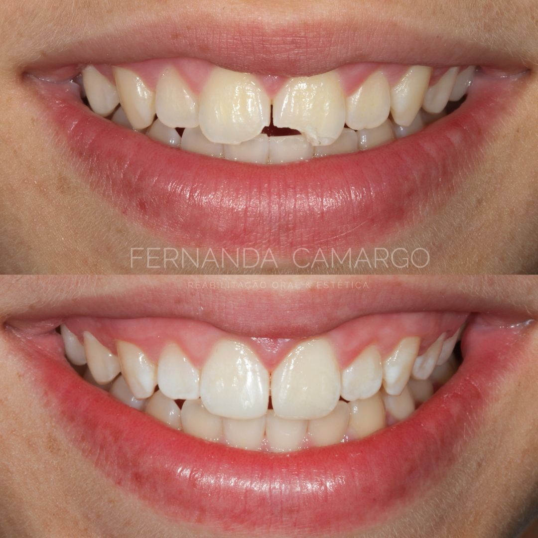 Fernanda Camargo Silveira-12