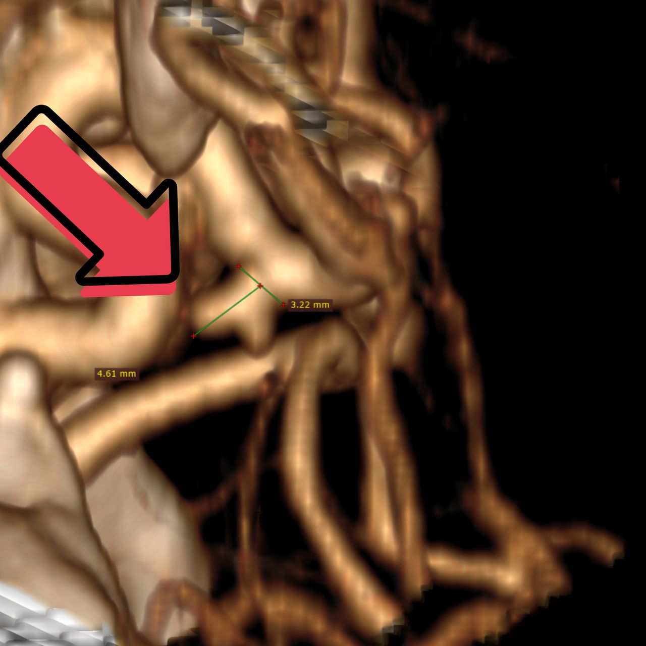 David Tafur Muñoz-1221