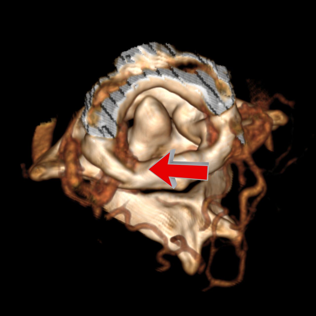David Tafur Muñoz-2049