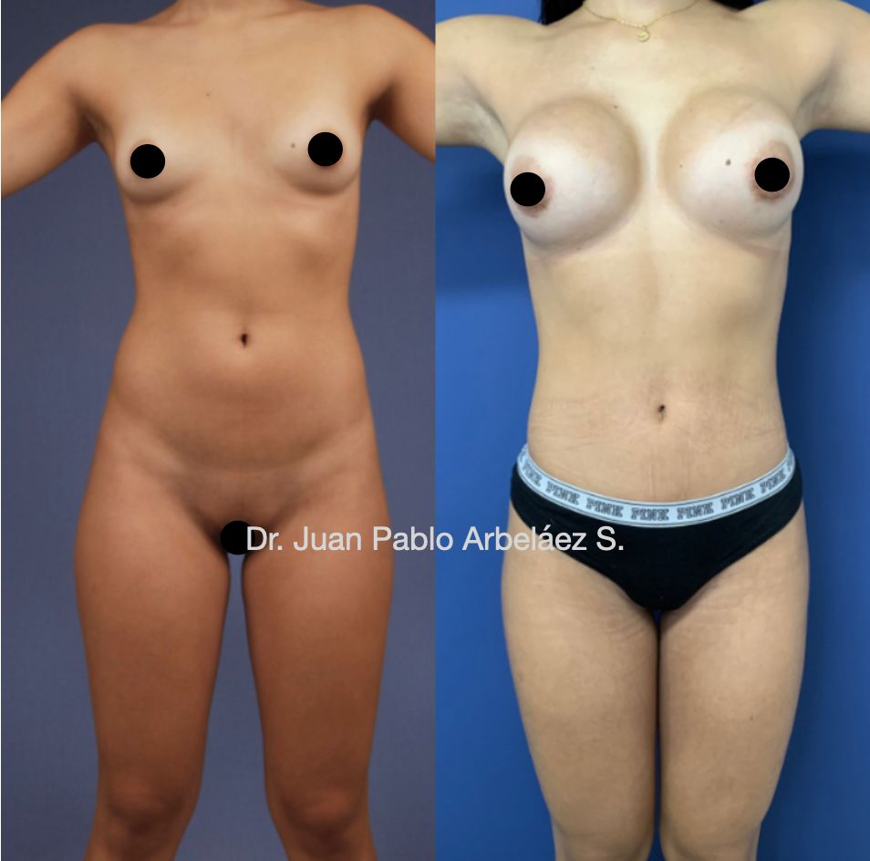 Juan Pablo Arbeláez Sierra-33