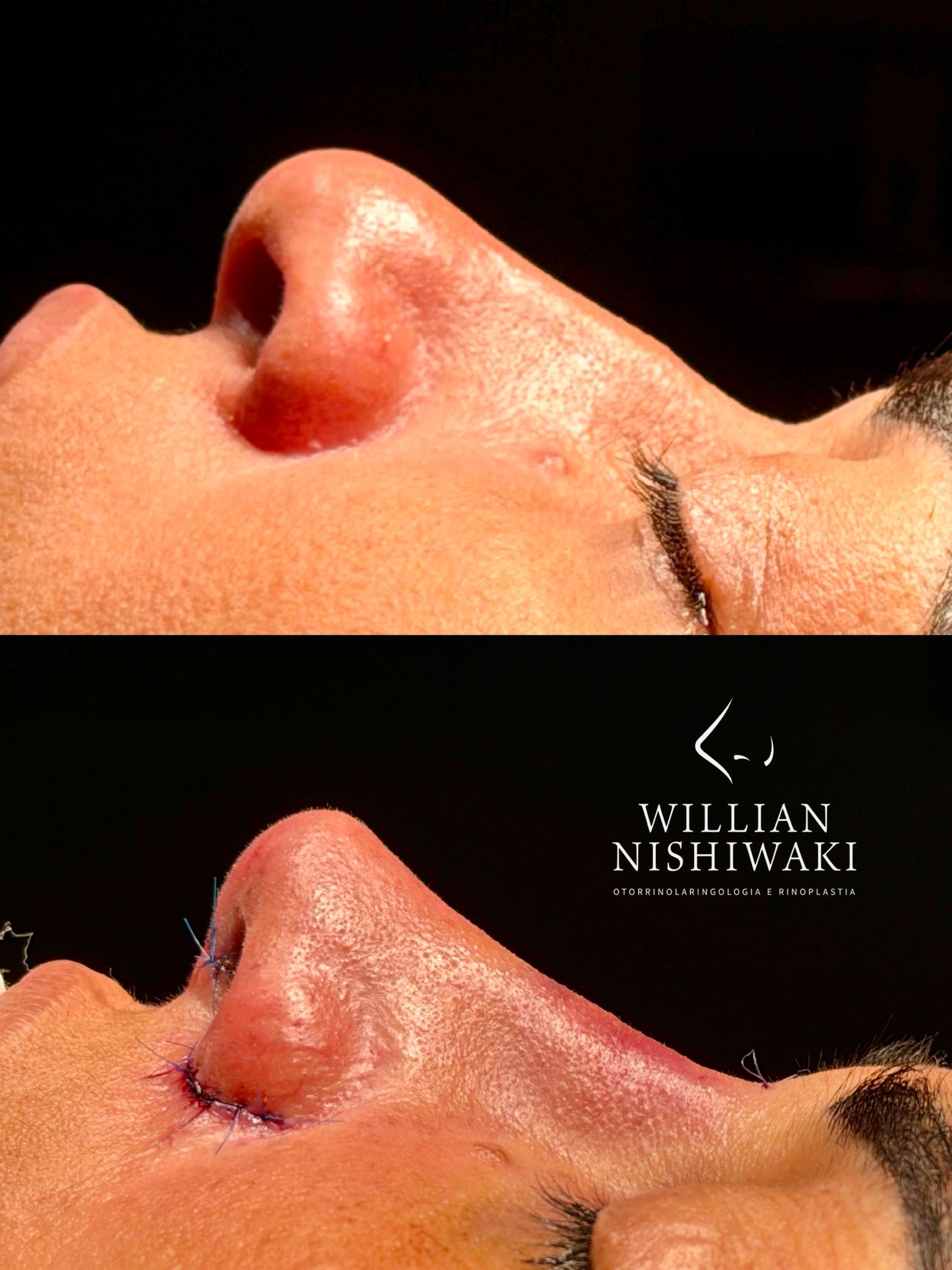 Willian  Nishiwaki Alves-1